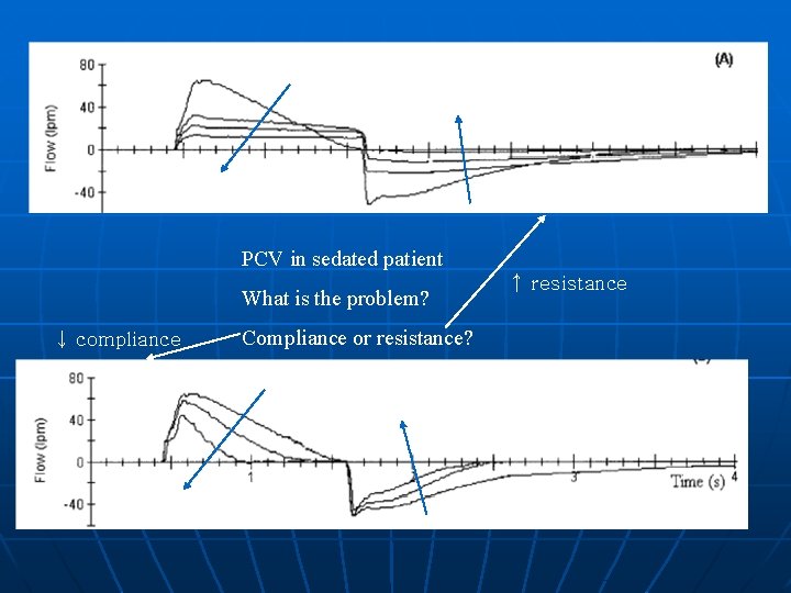 PCV in sedated patient What is the problem? ↓ compliance Compliance or resistance? ↑