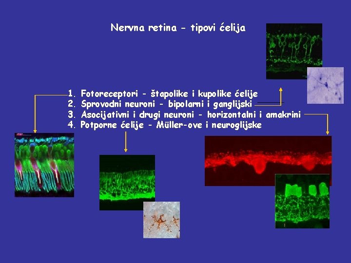 Nervna retina - tipovi ćelija 1. 2. 3. 4. Fotoreceptori - štapolike i kupolike