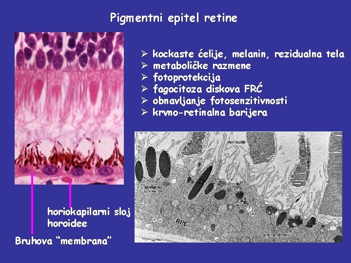 Pigmentni epitel retine Ø Ø Ø horiokapilarni sloj horoidee Bruhova “membrana” kockaste ćelije, melanin,