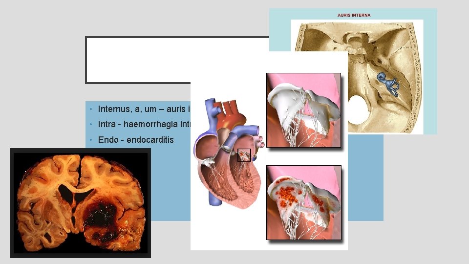 UVNITŘ • Internus, a, um – auris interna • Intra - haemorrhagia intracranialis •