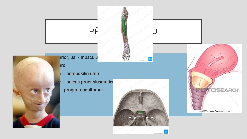 PŘEDNÍ /VPREDU • Anterior, us - musculus tibialis anterior • Antero • Ante –