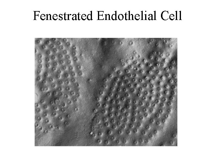 Fenestrated Endothelial Cell 