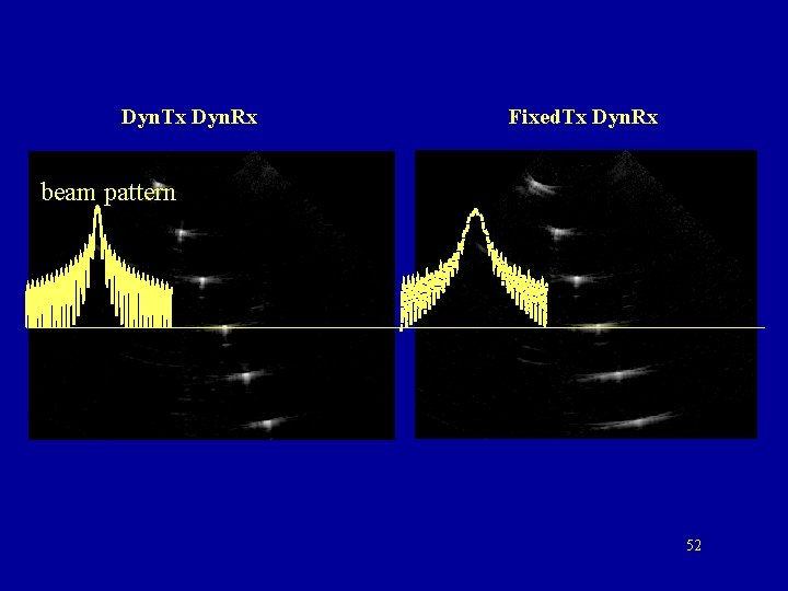 Dyn. Tx Dyn. Rx Fixed. Tx Dyn. Rx beam pattern 52 