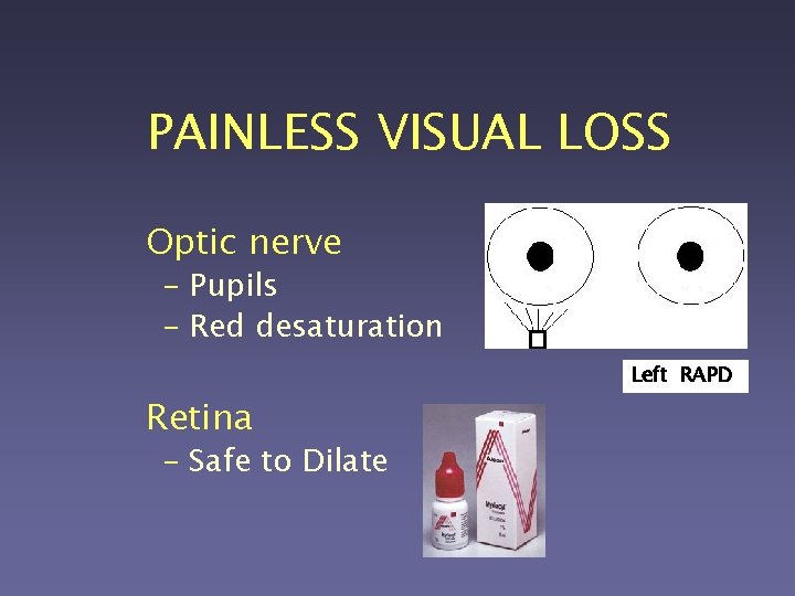 PAINLESS VISUAL LOSS Optic nerve – Pupils – Red desaturation Retina – Safe to