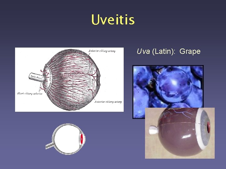 Uveitis Uva (Latin): Grape 