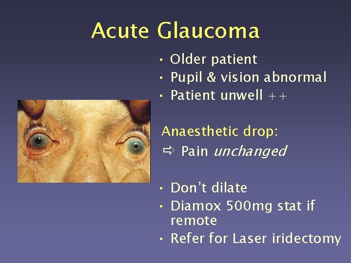 Acute Glaucoma • Older patient • Pupil & vision abnormal • Patient unwell ++
