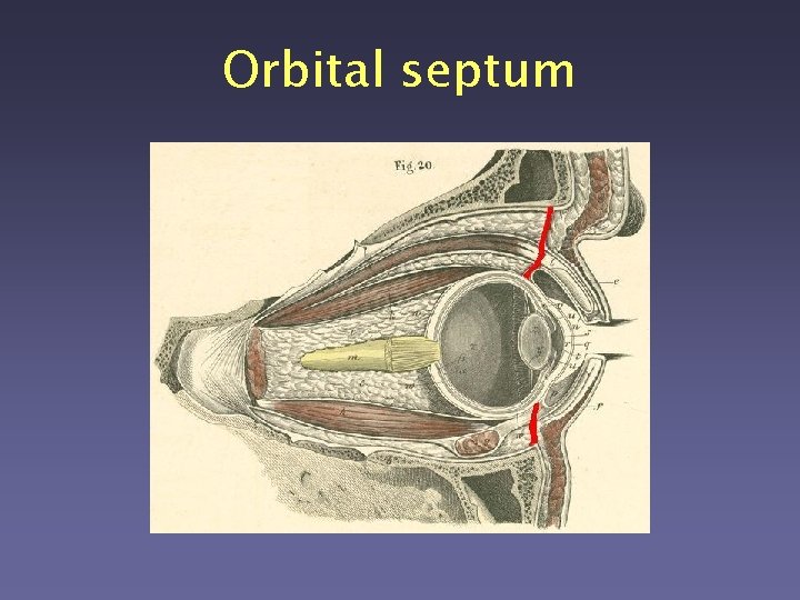Orbital septum 