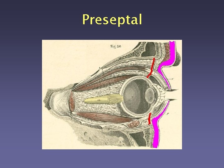 Preseptal 