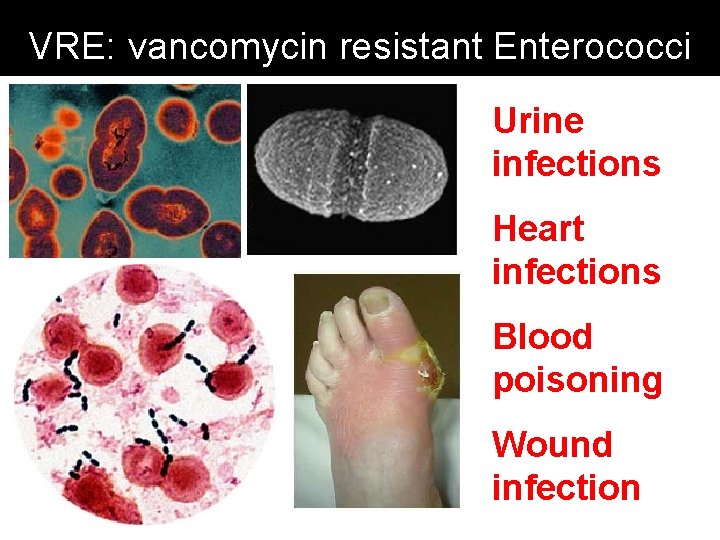 VRE: vancomycin resistant Enterococci Urine infections Heart infections Blood poisoning Wound infection 