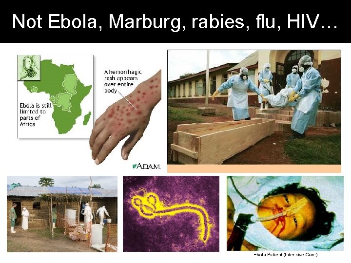 Not Ebola, Marburg, rabies, flu, HIV… 