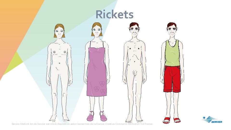 Rickets Servier Medical Art de Servier est mis à disposition selon les termes de
