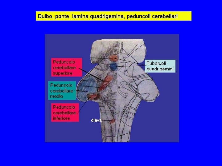 Bulbo, ponte, lamina quadrigemina, peduncoli cerebellari Bulbo, ponte, lamina quadrigemina, peduncoli cerebellari