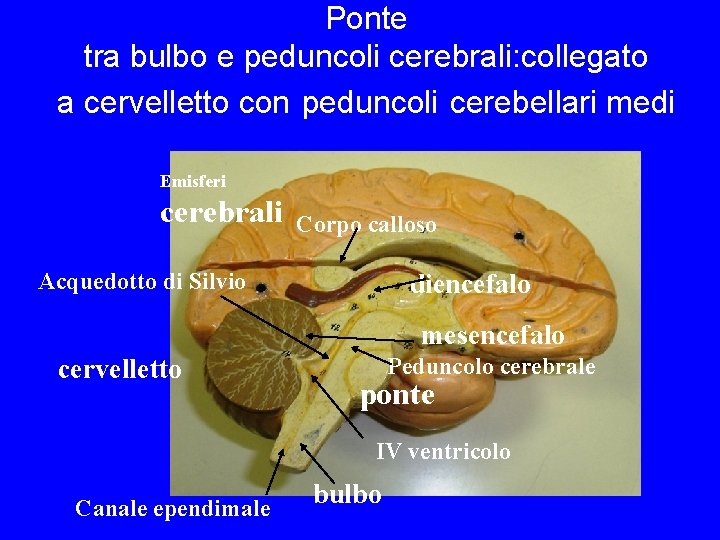 Ponte tra bulbo e peduncoli cerebrali: collegato a cervelletto con peduncoli cerebellari medi Emisferi Ponte tra bulbo e peduncoli cerebrali: collegato a cervelletto con peduncoli cerebellari medi Emisferi