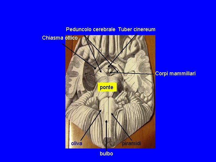 Peduncolo cerebrale Tuber cinereum Chiasma ottico Corpi mammillari ponte oliva piramidi bulbo Peduncolo cerebrale Tuber cinereum Chiasma ottico Corpi mammillari ponte oliva piramidi bulbo