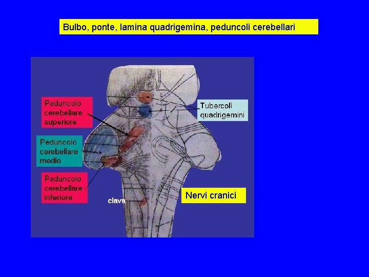 Bulbo, ponte, lamina quadrigemina, peduncoli cerebellari Nervi cranici Bulbo, ponte, lamina quadrigemina, peduncoli cerebellari Nervi cranici