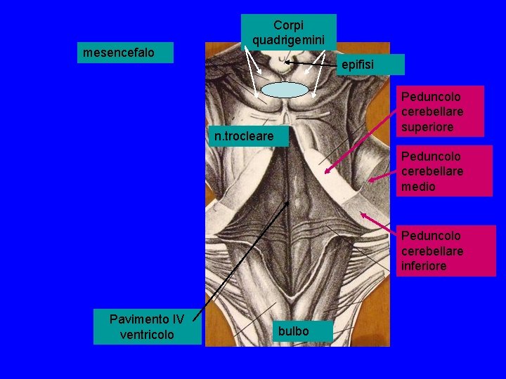 mesencefalo Corpi quadrigemini epifisi Peduncolo cerebellare superiore n. trocleare Peduncolo cerebellare medio Peduncolo cerebellare mesencefalo Corpi quadrigemini epifisi Peduncolo cerebellare superiore n. trocleare Peduncolo cerebellare medio Peduncolo cerebellare