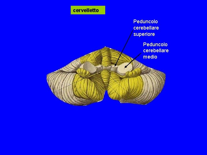 cervelletto Peduncolo cerebellare superiore Peduncolo cerebellare medio cervelletto Peduncolo cerebellare superiore Peduncolo cerebellare medio