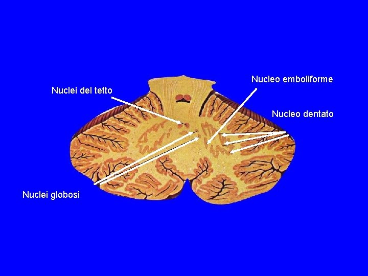 Nucleo emboliforme Nuclei del tetto Nucleo dentato Nuclei globosi Nucleo emboliforme Nuclei del tetto Nucleo dentato Nuclei globosi