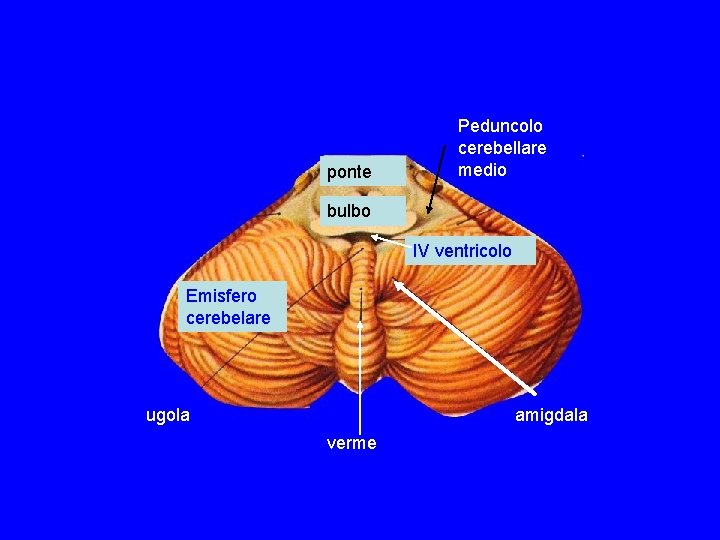 ponte Peduncolo cerebellare medio bulbo IV ventricolo Emisfero cerebelare ugola amigdala verme ponte Peduncolo cerebellare medio bulbo IV ventricolo Emisfero cerebelare ugola amigdala verme