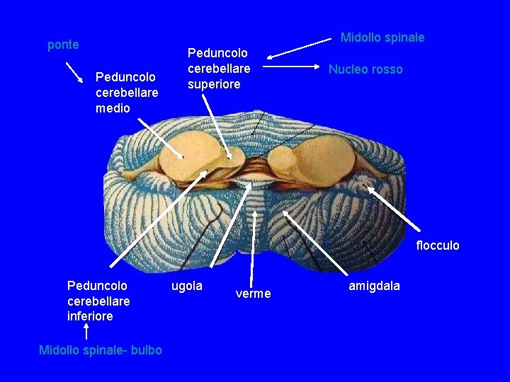 Midollo spinale ponte Peduncolo cerebellare medio Peduncolo cerebellare superiore Nucleo rosso flocculo Peduncolo cerebellare Midollo spinale ponte Peduncolo cerebellare medio Peduncolo cerebellare superiore Nucleo rosso flocculo Peduncolo cerebellare