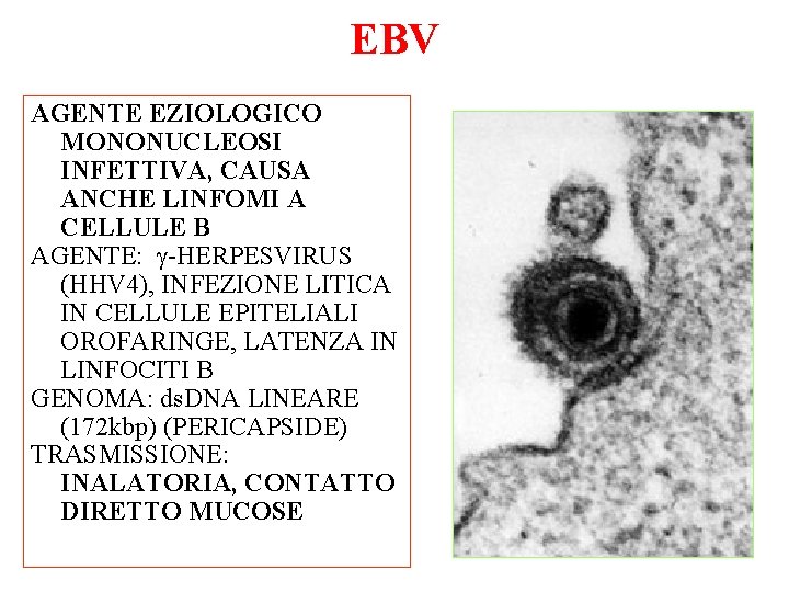 EBV AGENTE EZIOLOGICO MONONUCLEOSI INFETTIVA, CAUSA ANCHE LINFOMI A CELLULE B AGENTE: g-HERPESVIRUS (HHV