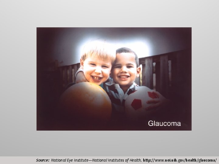 Source: National Eye Institute—National Institutes of Health, http: //www. nei. nih. gov/health/glaucoma/ 