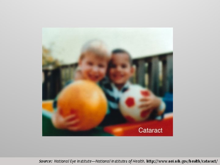 Source: National Eye Institute—National Institutes of Health, http: //www. nei. nih. gov/health/cataract/ 