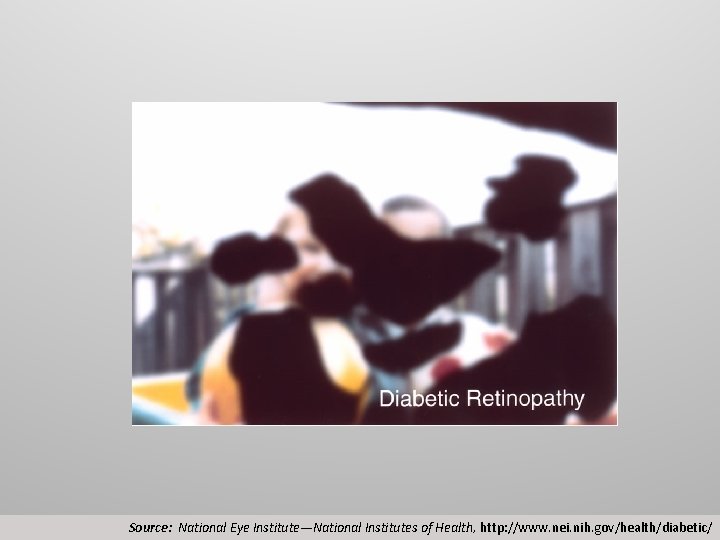 Source: National Eye Institute—National Institutes of Health, http: //www. nei. nih. gov/health/diabetic/ 