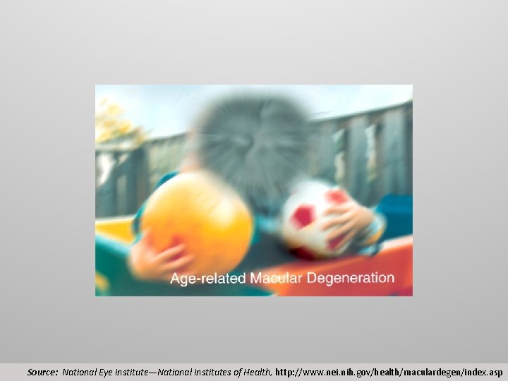 Source: National Eye Institute—National Institutes of Health, http: //www. nei. nih. gov/health/maculardegen/index. asp 