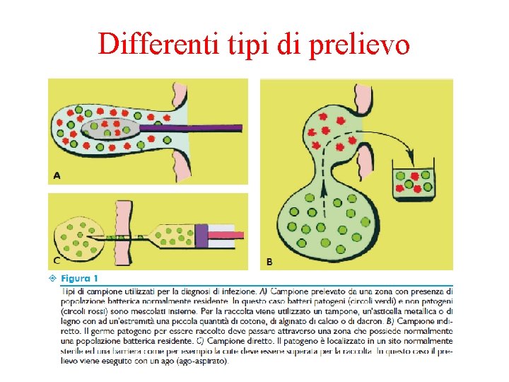 Differenti tipi di prelievo 