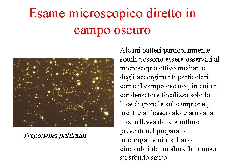 Esame microscopico diretto in campo oscuro Treponema pallidum Alcuni batteri particolarmente sottili possono essere