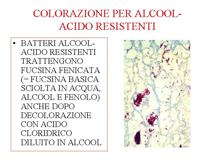 COLORAZIONE PER ALCOOLACIDO RESISTENTI • BATTERI ALCOOLACIDO RESISTENTI TRATTENGONO FUCSINA FENICATA (= FUCSINA BASICA