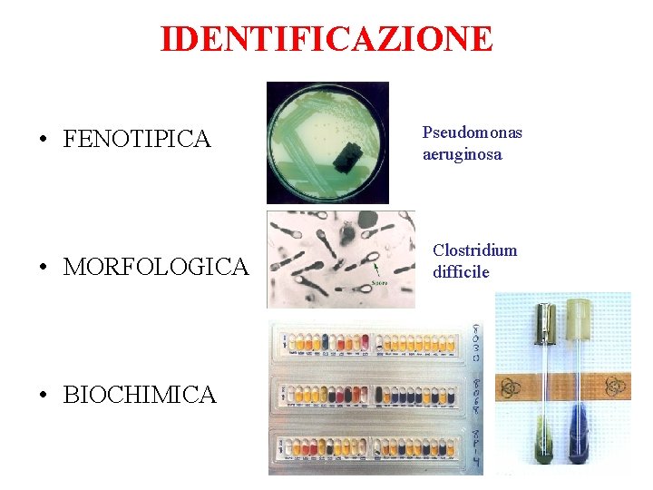 IDENTIFICAZIONE • FENOTIPICA • MORFOLOGICA • BIOCHIMICA Pseudomonas aeruginosa Clostridium difficile 
