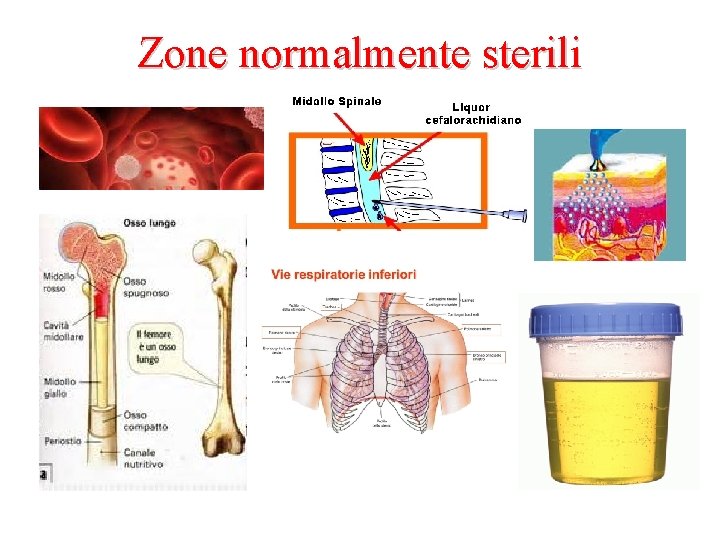 Zone normalmente sterili 