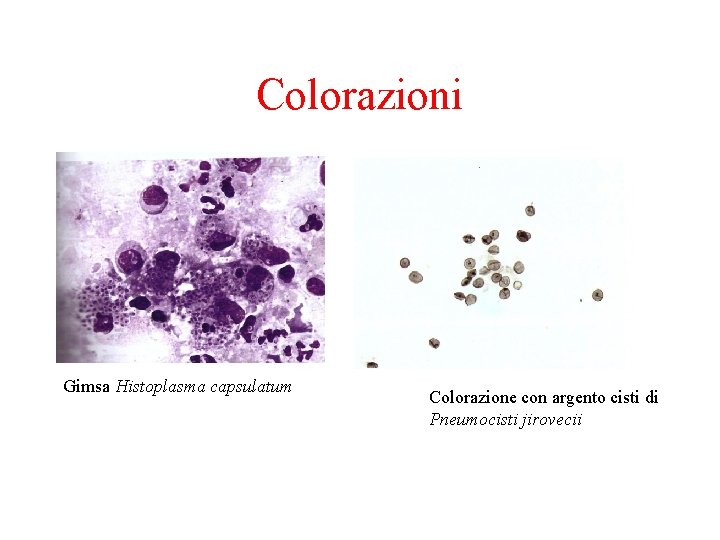 Colorazioni Gimsa Histoplasma capsulatum Colorazione con argento cisti di Pneumocisti jirovecii 