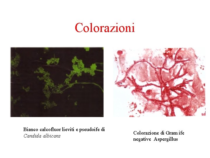 Colorazioni Bianco calcofluor lieviti e pseudoife di Candida albicans Colorazione di Gram ife negative