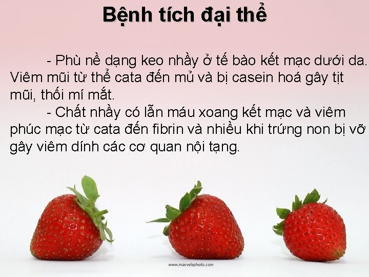 Bệnh tích đại thể Phù nề dạng keo nhầy ở tế bào kết mạc