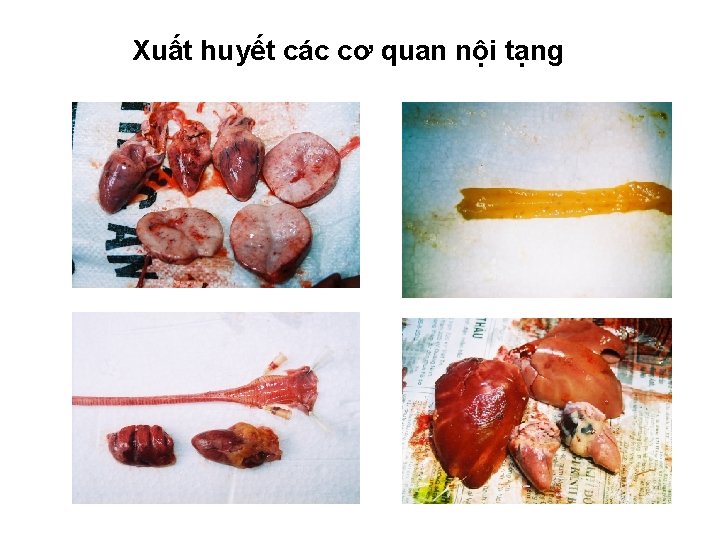 Xuất huyết các cơ quan nội tạng 