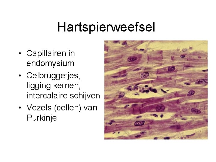 Hartspierweefsel • Capillairen in endomysium • Celbruggetjes, ligging kernen, intercalaire schijven • Vezels (cellen)