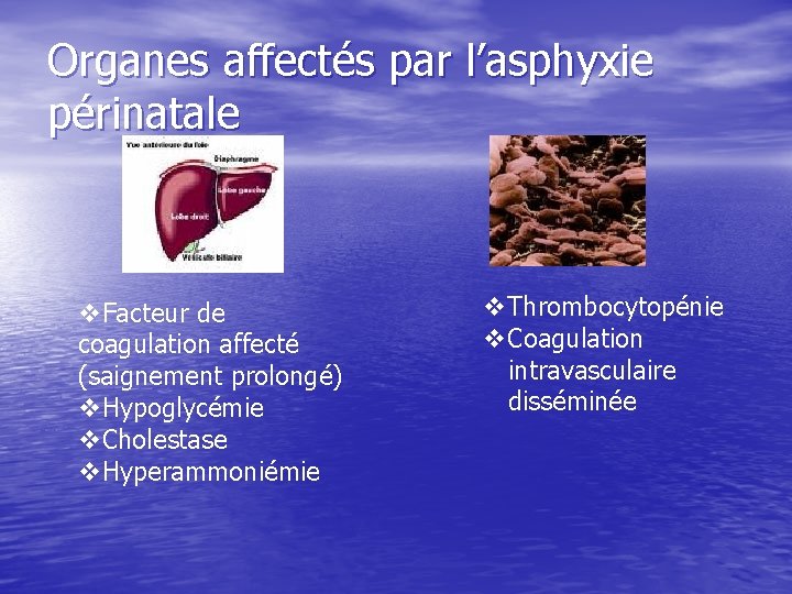 Organes affectés par l’asphyxie périnatale v. Facteur de coagulation affecté (saignement prolongé) v. Hypoglycémie