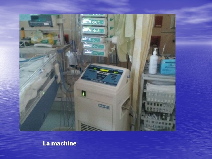 La machine 