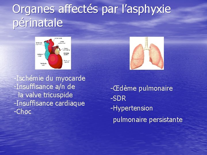 Organes affectés par l’asphyxie périnatale -Ischémie du myocarde -Insuffisance a/n de la valve tricuspide