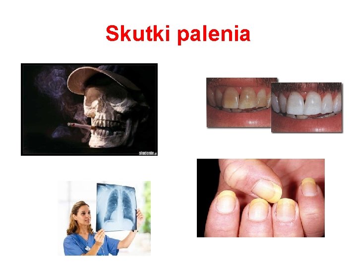 Skutki palenia 