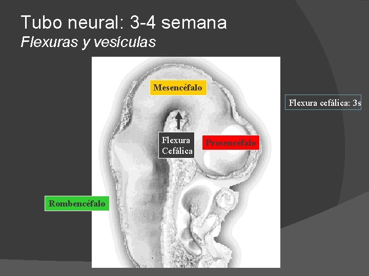 Tubo neural: 3 -4 semana Flexuras y vesículas Mesencéfalo Flexura cefálica: 3 s Flexura