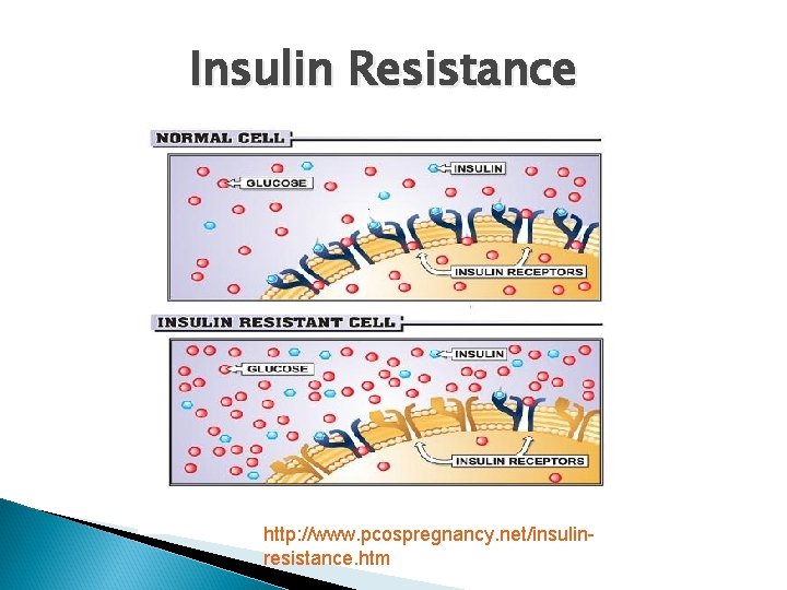 Insulin Resistance http: //www. pcospregnancy. net/insulinresistance. htm 