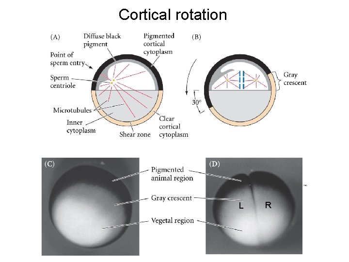 Cortical rotation L R 