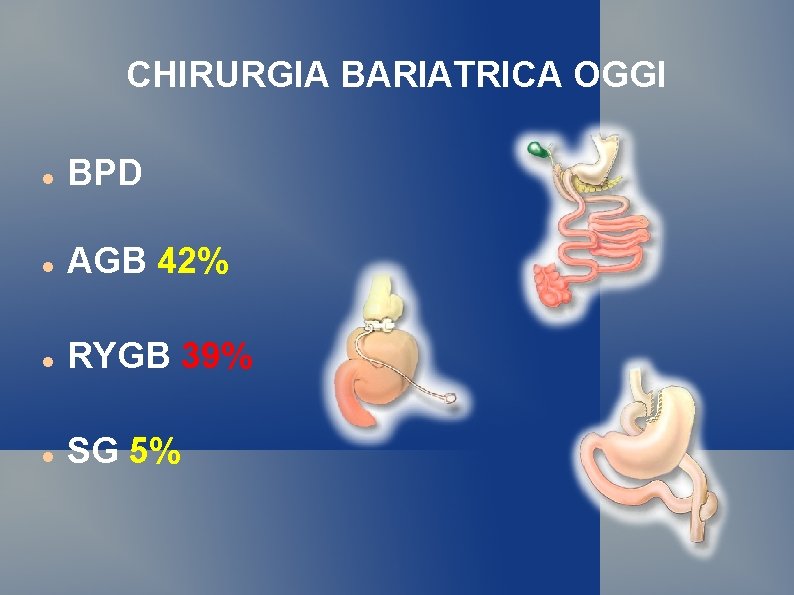 CHIRURGIA BARIATRICA OGGI BPD AGB 42% RYGB 39% SG 5% 