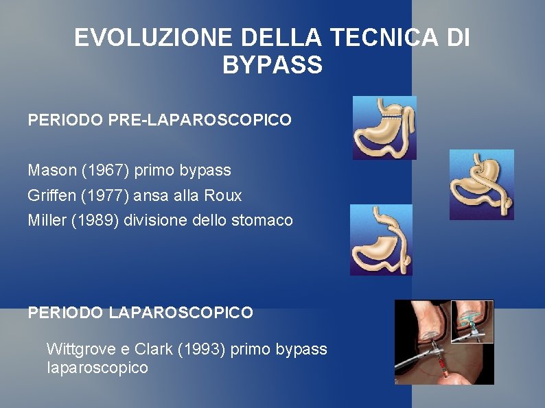 EVOLUZIONE DELLA TECNICA DI BYPASS PERIODO PRE-LAPAROSCOPICO Mason (1967) primo bypass Griffen (1977) ansa