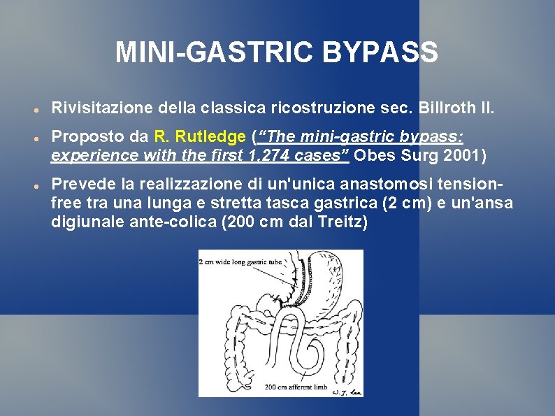 MINI-GASTRIC BYPASS Rivisitazione della classica ricostruzione sec. Billroth II. Proposto da R. Rutledge (“The