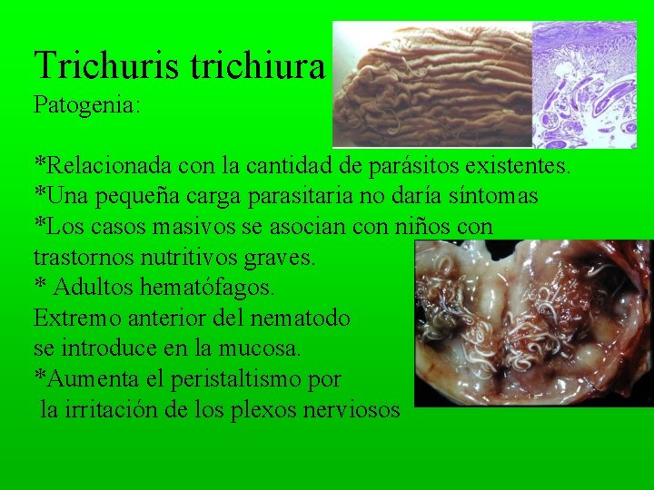 Trichuris trichiura Patogenia: *Relacionada con la cantidad de parásitos existentes. *Una pequeña carga parasitaria